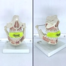 Protetor Bucal Superior Spank Profissional - Foto 4