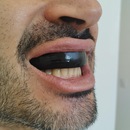 Protetor Bucal Esportivo Powerplay Cushion com Estojo - Foto 5