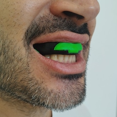 Protetor Bucal Esportivo Powerplay TitanX com Estojo - Foto 3